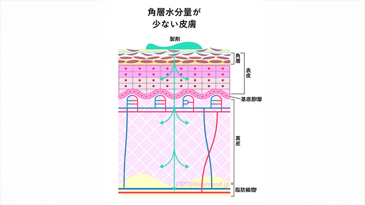 角層水分量が少ない皮膚の写真
