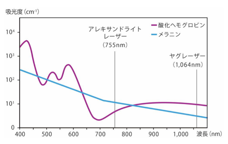 GentleMax Proの性能の写真