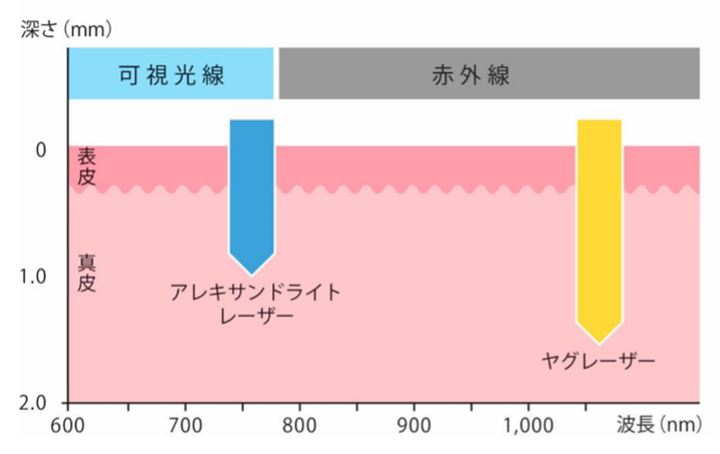 GentleMax Proの性能の写真