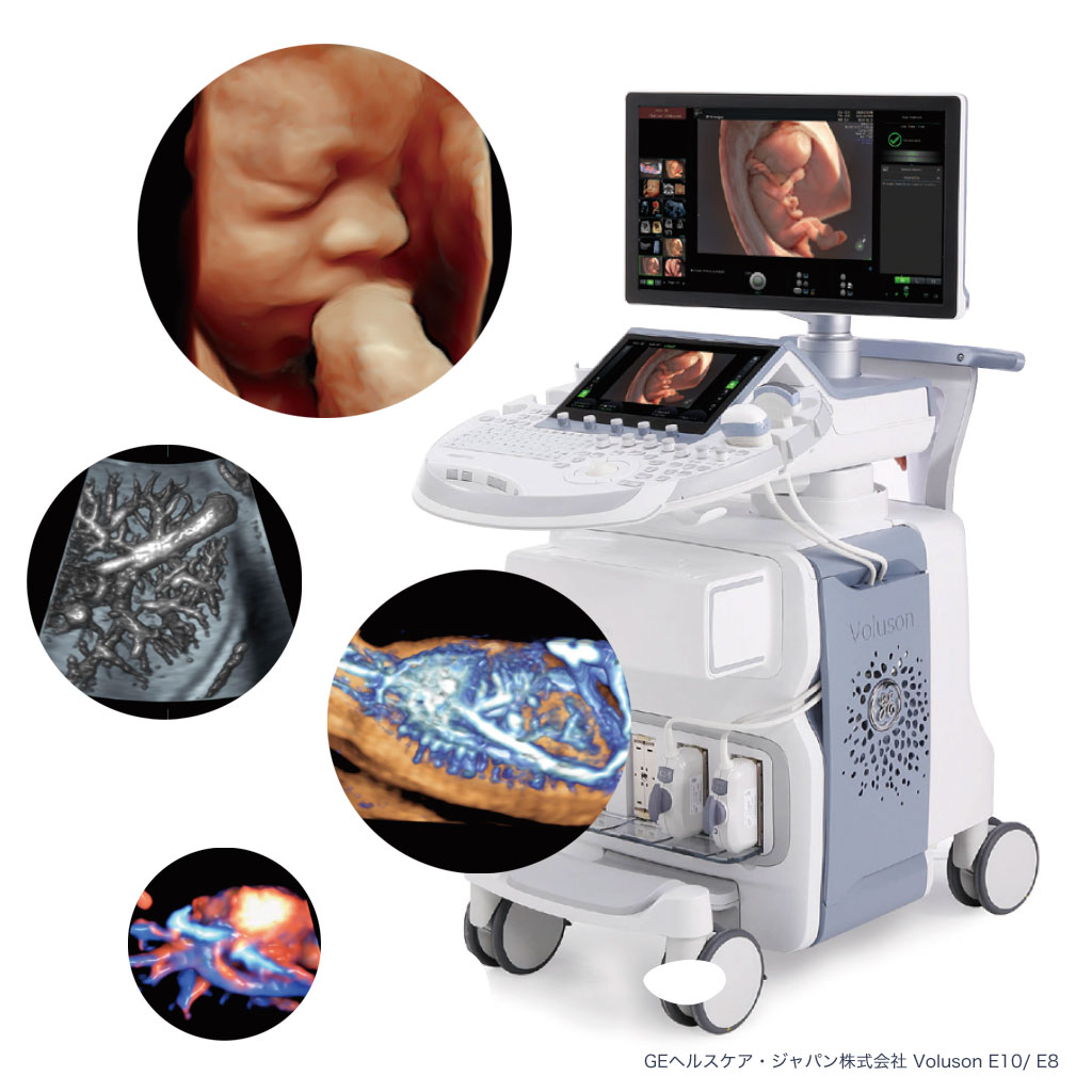 胎児スクリーニング検査のイメージ