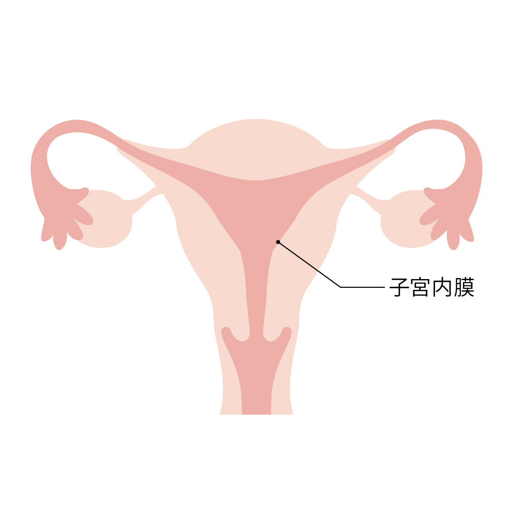 ERA検査 （子宮内膜着床能検査）