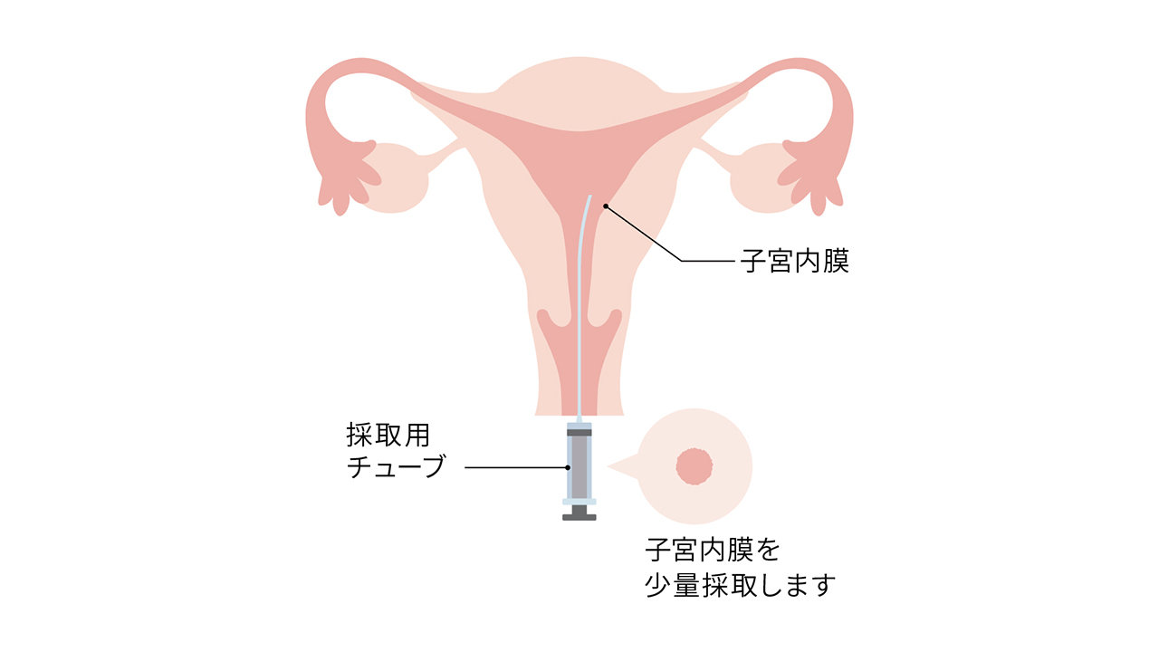 採取