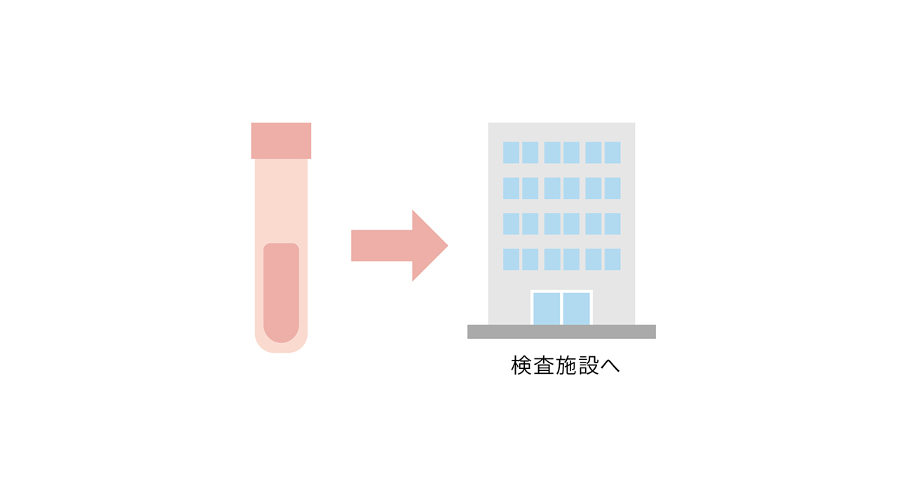 検体の送付