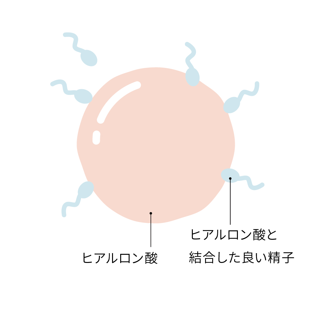 PICSI （ピクシー）