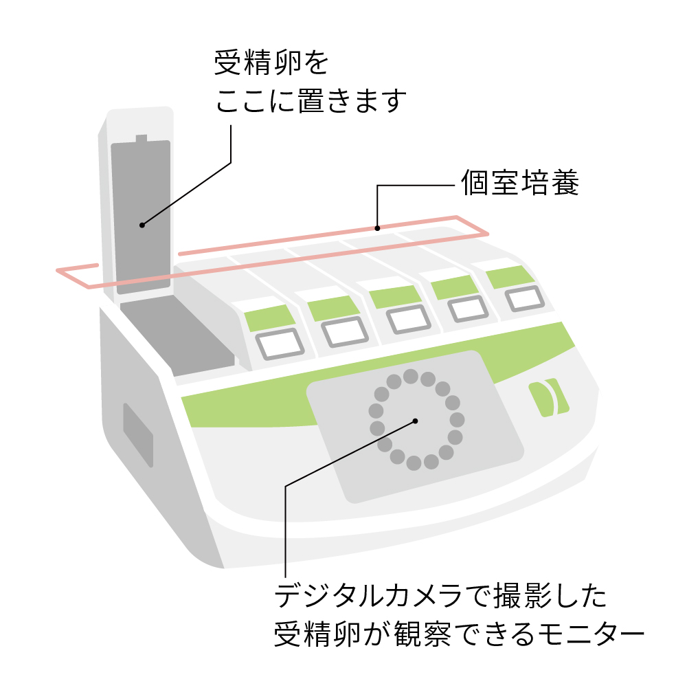 タイムラプス培養