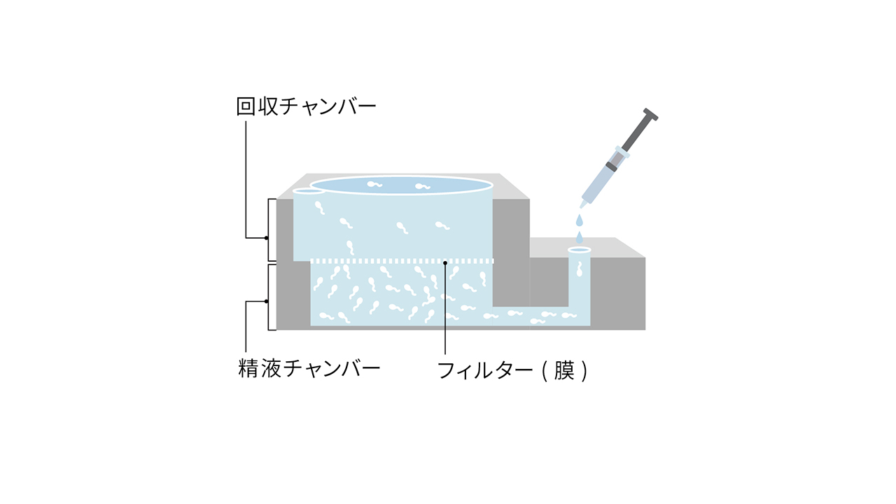 ZyMōtプレートに注入