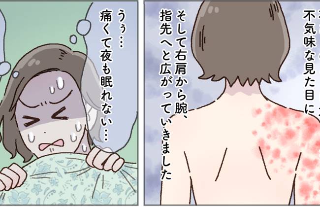 「激痛で夜も眠れず、赤い発疹まで…」免疫力の低下から思わぬ病気を発症!【体験談】