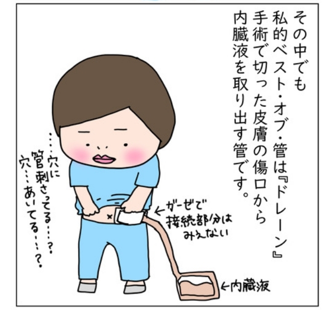 大腸がんらしい 49