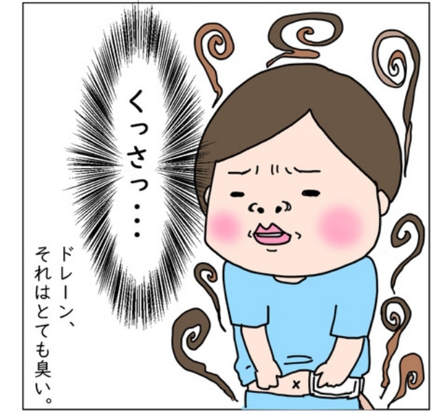大腸がんらしい 49