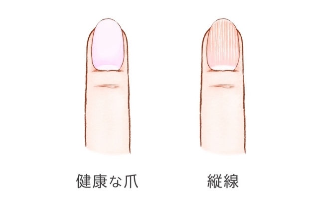 爪に縦線が 老け見えする指先をきれいに ネイルケアで気分上々 40代 50代の更年期症状 ダイエット シミ 白髪 老眼などのお悩み解決 ウーマンカレンダー