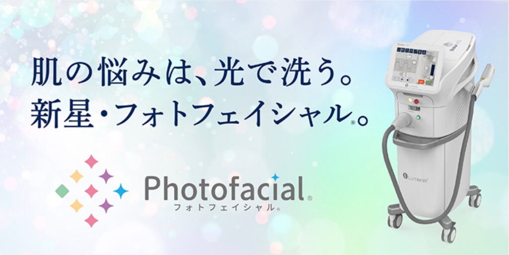 フォトフェイシャル「steller」の写真